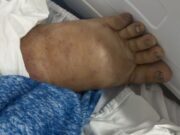 16:57 –
Família de paciente internado em UPA com suspeita de dengue hemorrágica busca vaga em hospital para hemodiálise