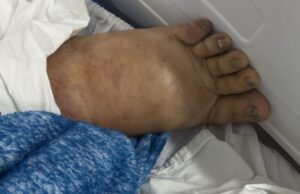 16:57 –
Família de paciente internado em UPA com suspeita de dengue hemorrágica busca vaga em hospital para hemodiálise