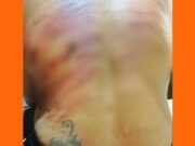 17:06 –
Mulher sequestrada duas vezes por faccionados é torturada com mais de 50 chibatadas