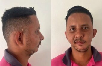 17:46 –
Cuiabano com má-formação facial caçoado por Carlinhos Maia aguarda cirurgia de R$ 471 mil há mais de 10 anos