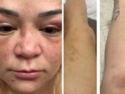 21:23 –
Advogada presa por agressão diz que verdade será restabelecida e mostra supostos hematomas: "fiquei atordoada de tanta paulada"