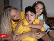 Zika: como estão as crianças com microcefalia, 10 anos após a epidemia