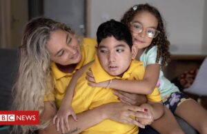 Zika: como estão as crianças com microcefalia, 10 anos após a epidemia