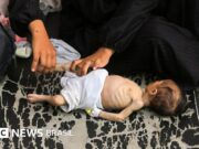Fome em Gaza: ‘Pais estão famintos demais para cuidar das crianças’