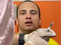 Bandeirinha é agredido e leva três pontos na boca em jogo do Mixto